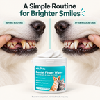 Dental Finger Wipes